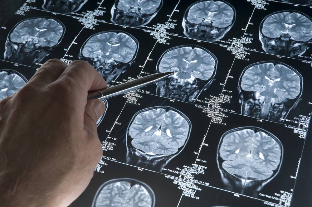 Participants in one study will have ultrasounds and MRIs. Photo: iStock