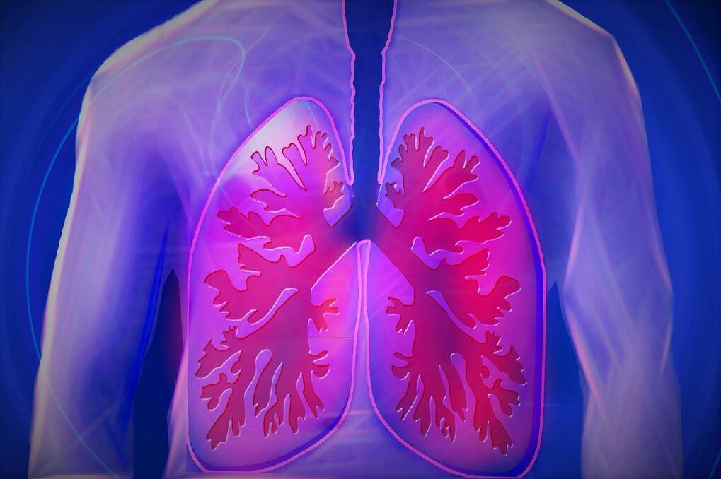 Chronic obstructive pulmonary disease is estimated to affect around 1.45 million Australians.