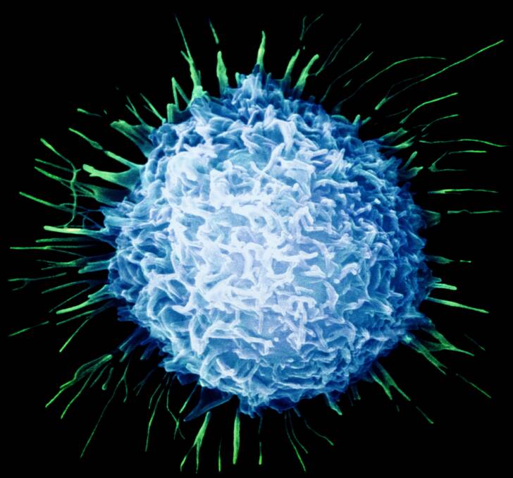 CELL MARKERS - A blood test could predict whether prostate cancer will spread.