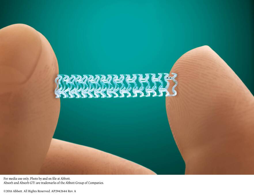 RECALL - The Absorb BVS system implanted stent is being recalled by the TGA. Photo: Abbott Vascular.