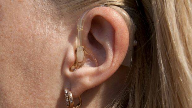 Hearing aids range in price from around $1500 to $15,000 a pair, the ACCC says. Photo: AigarsR