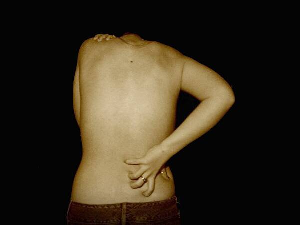 KILLER PAIN - Back pain may be linked to an increased chance of death.
