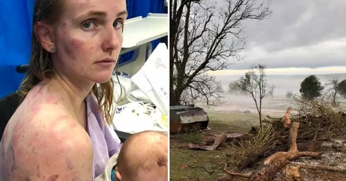 Kingaroy mother Fiona Simpson shielded her daughter as they were hammered by hail. Picture: Facebook