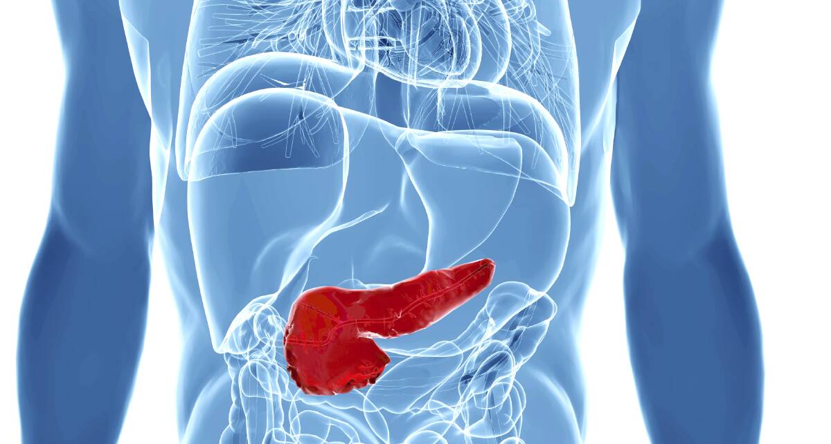DEADLY: More than 2,900 people are diagnosed with pancreatic cancer in Australia every year. Photo: iStock