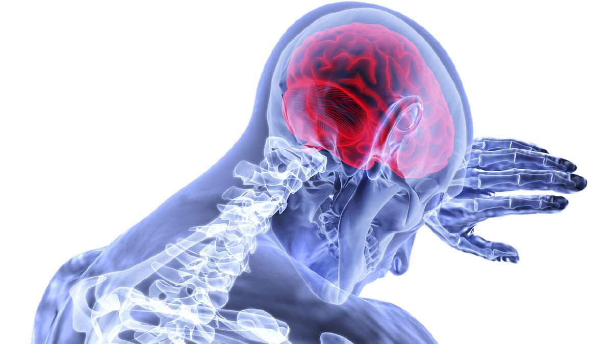 BRAINS TRUST: Researchers from the University of South Australia have developed a new program that will allow stroke victims to re-train their brains at home.