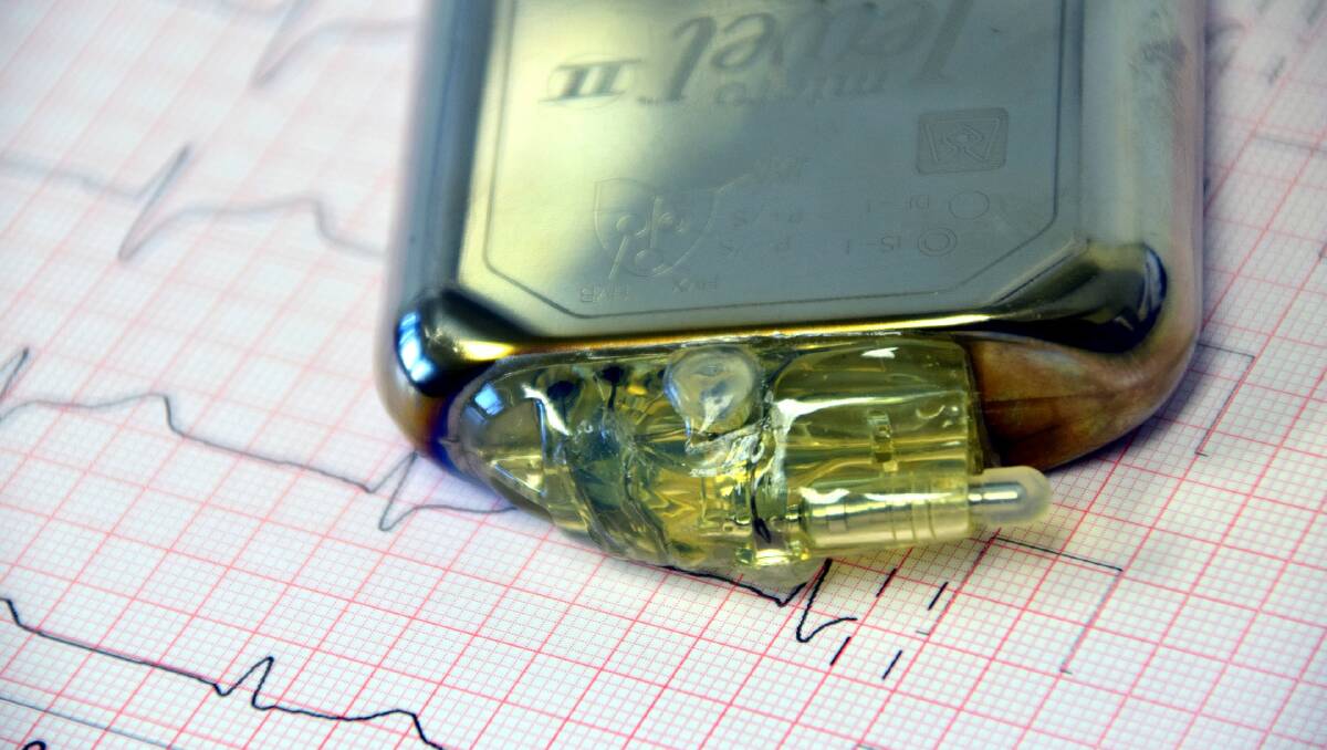 BEATBOX: Pacemakers and a range of other medical devices are now cheaper for private healthcare clients.
