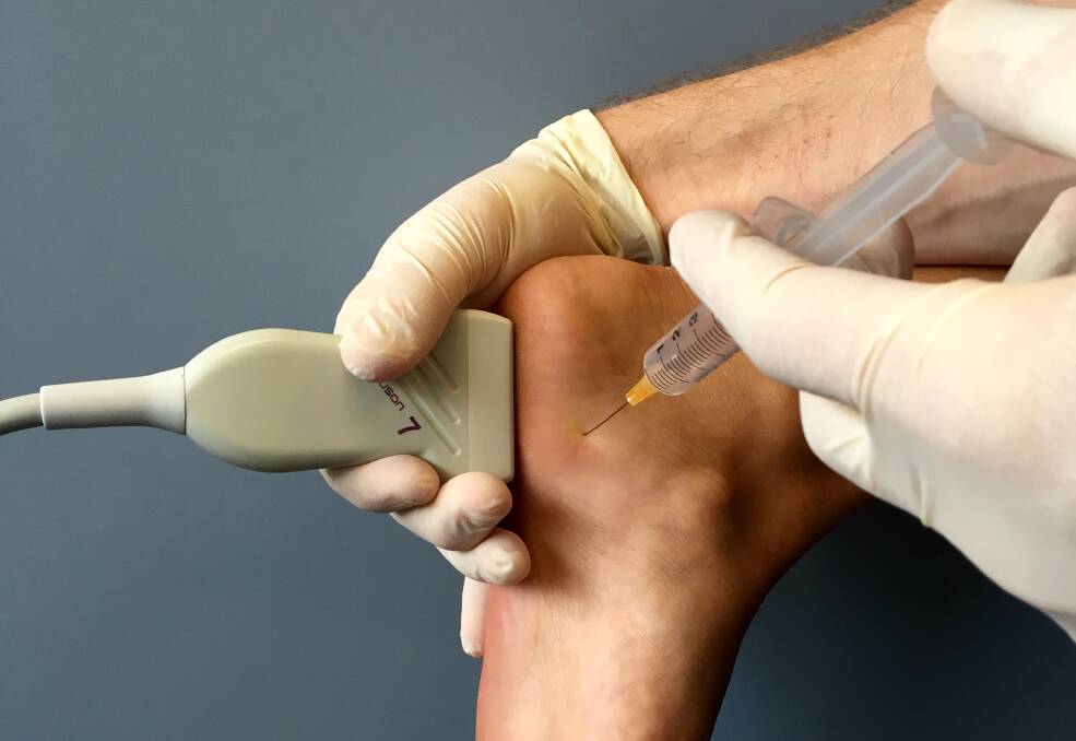 OUCH: Corticosteroid injections versus orthotics.