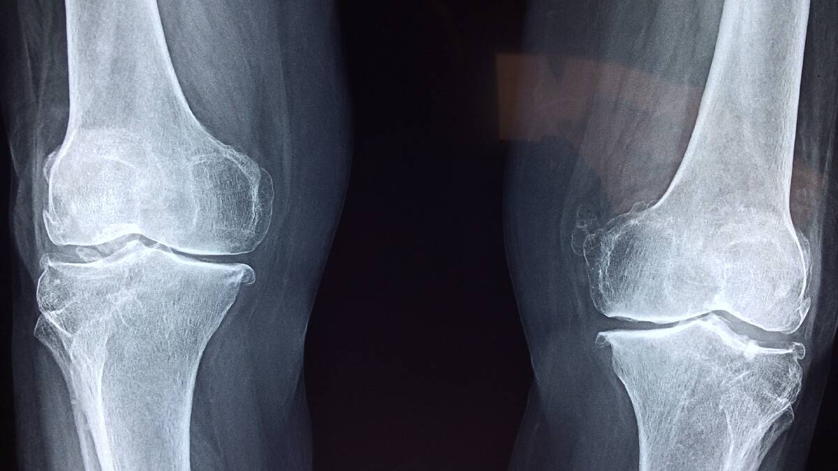 The worst jobs for your knees