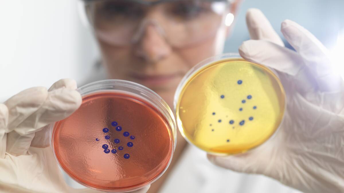 SUPERBUGS: The cost of UTIs could soar if nothing is done to stop the rise of antibiotic resistant bacteria.