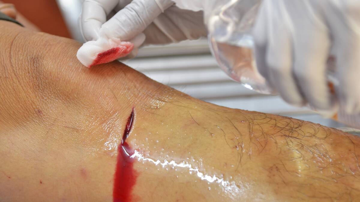 Tendon like sutures a game changer