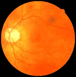 Scan of a human retina. Credit: UK Biobank.
