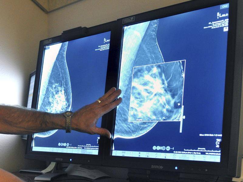 Women at risk of breast cancer had less regret knowing test results than those choosing not to know.