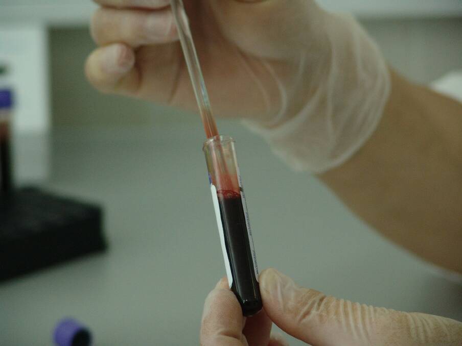 The new blood test could be a game changer in early cancer detection.
