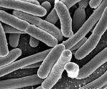 Overuse of antibiotics is creating resistant bacteria.