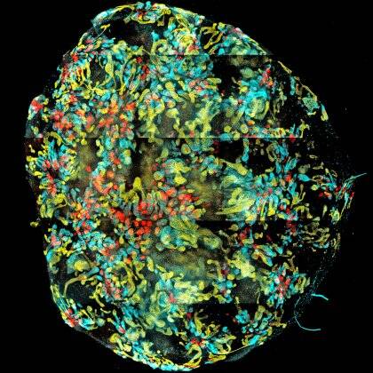 The mini-kidney grown by University of Queensland scientists. Photo: Minoru Takasato