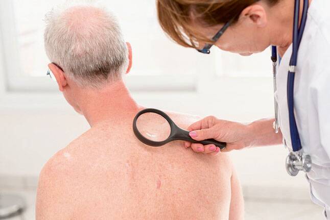GET CHECKED – Regular skin checks may detect melanoma at an early stage.