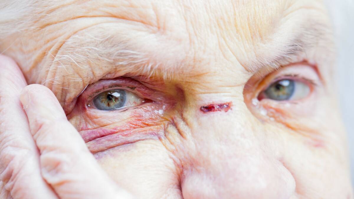 CRIME STATISTICS: Older people likely to know the person who assaults them.