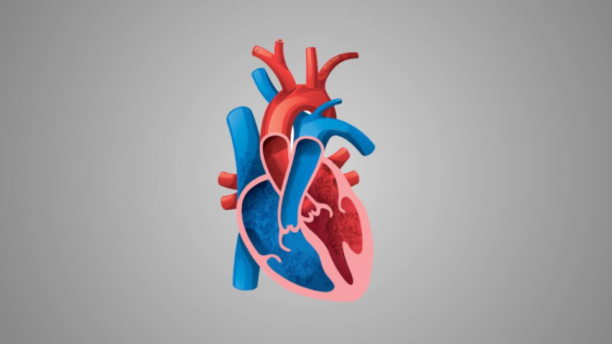 Heart failure with preserved ejection fraction results in the heart becoming too stiff to properly fill with blood reducing the supply of oxygen to the body. Picture supplied