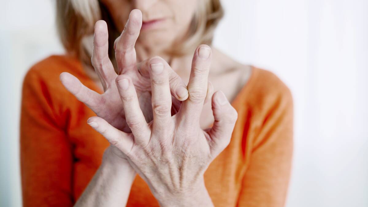 Hand osteoarthritis can effect one in two women and one in four men by age 85. Picture shutterstock
