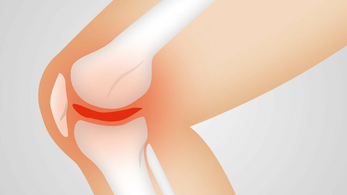 Low carb diet reduced pain in people with knee arthritis.