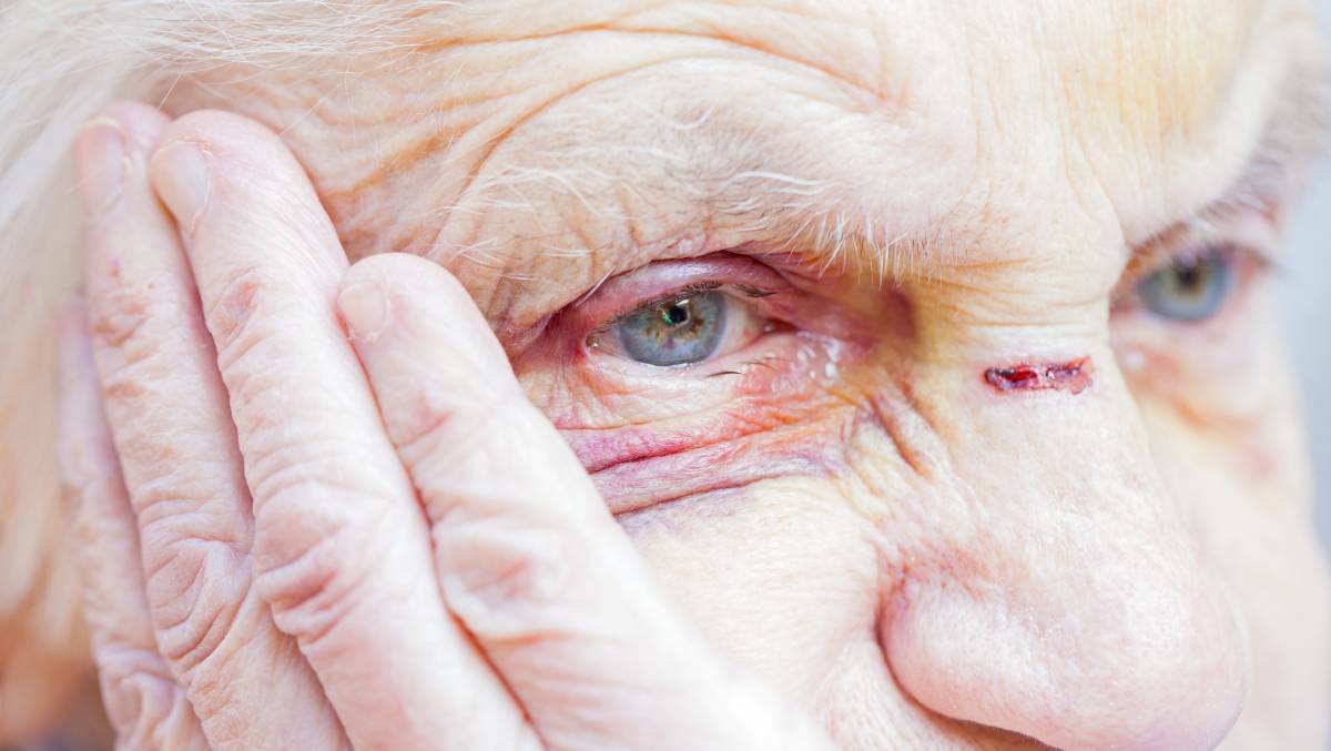 Elder abuse can be psychological, financial, social physical, sexual or neglect. Most victims suffer more than one type. Picture Shutterstock