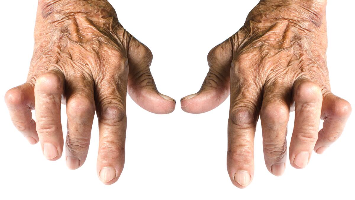 New website to help people with rheumatoid arthritis. Image Shutterstock. 